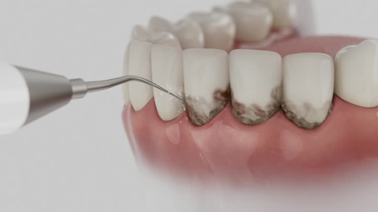 Reliable Dental Implants contractor in Checotah, OK by Smile Center Dentistry